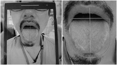 Construction of a Standardized Tongue Image Database for Diagnostic Education: Development of a Tongue Diagnosis e-Learning System